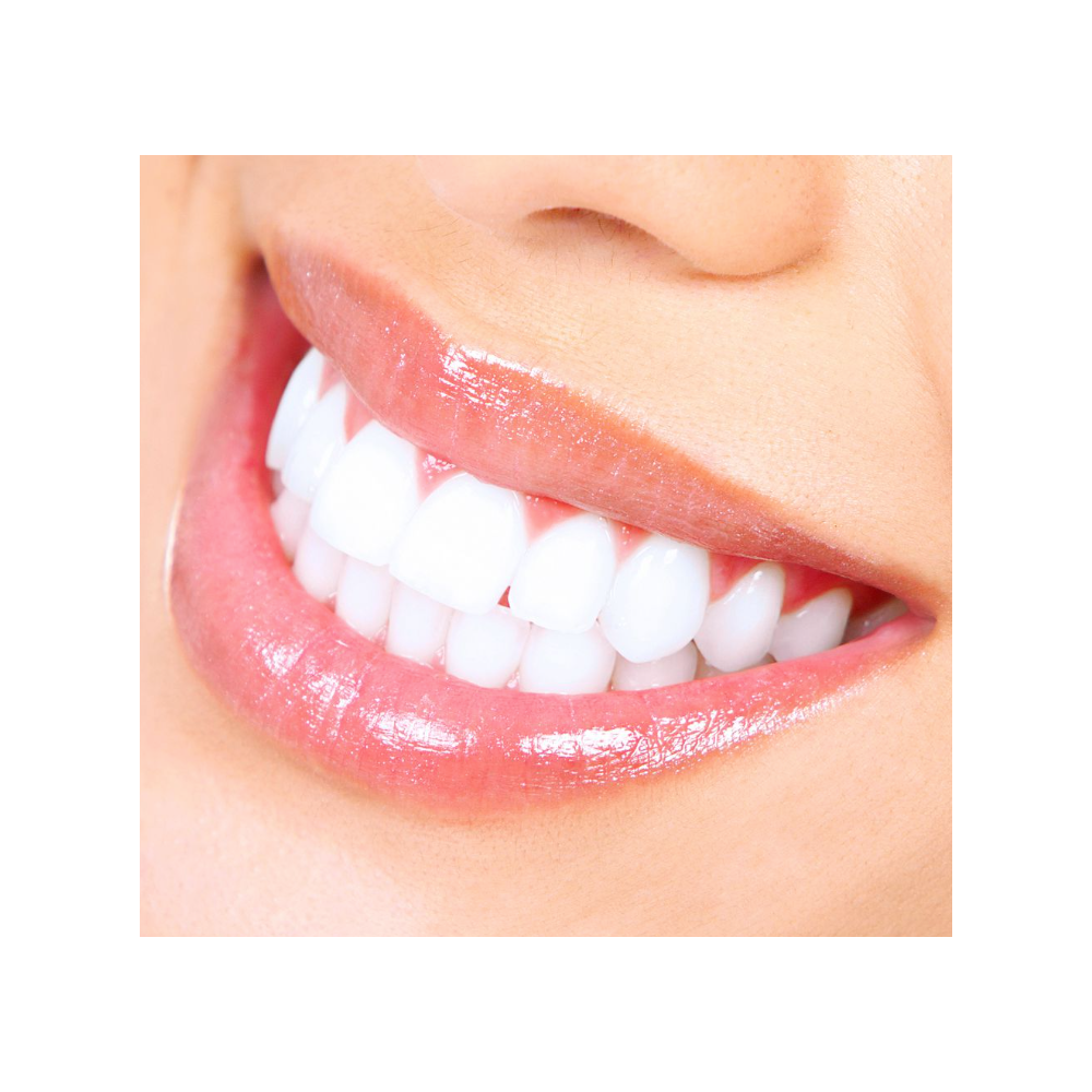 Custom Teeth Whitening Certificate for Kit and Office Visit